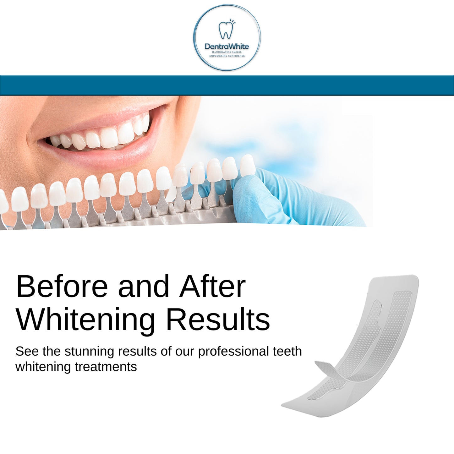 Teeth Whitening Strips - 28 treatments